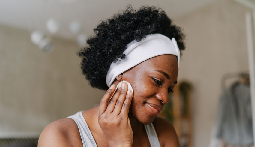 Is Azelaic Acid Good for Acne?